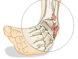 Common Netball Injuries & How Physiotherapy Keeps You On The Court Common Netball Injuries & How Physiotherapy Keeps You On The Court